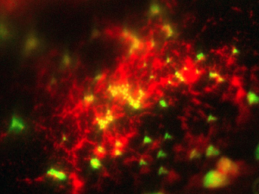 バイオフィルム 蛍光顕微鏡画像 SYTO9 Ruby Biofirm Matrix Stain