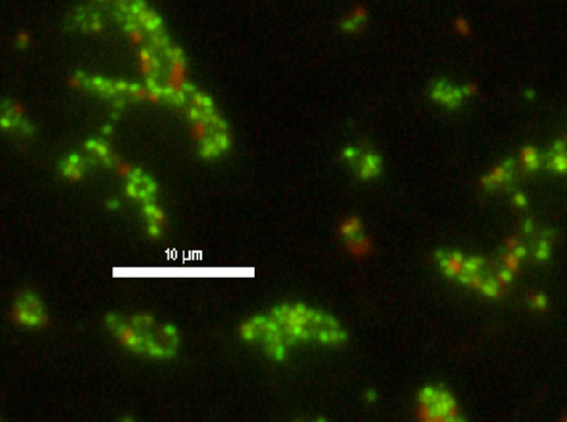 緑膿菌 蛍光染色画像 （SYTO9 ＋ PI）