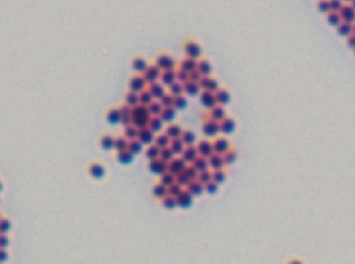 グラム陽性菌（細胞壁が厚い） Staphylococcus aureus