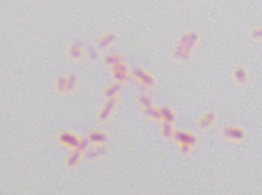 グラム陰性菌（薄い細胞壁にリン脂質の外膜） Escherichia coli